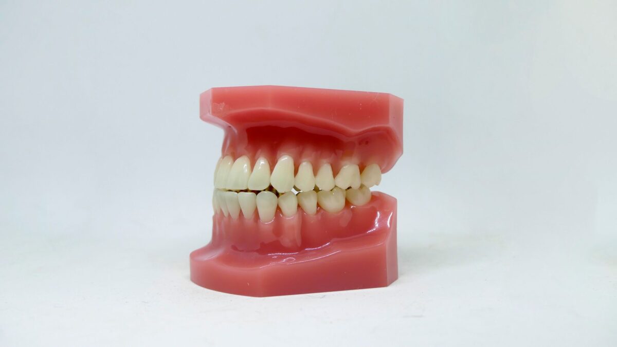 cacher dents pourries options esthétiques permettent